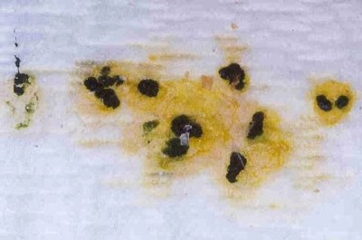 Gelbliche Flecken im Kot zeigen eine Lebererkrankung an