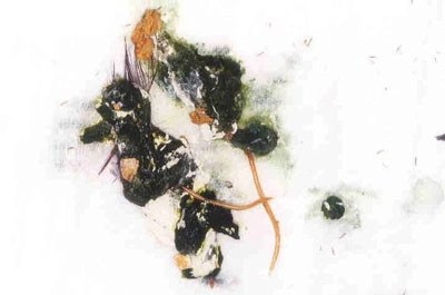 Spülwürmer im Vogelkot